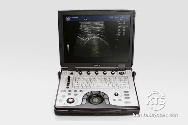 GE Logiq E Portable Ultrasound System
